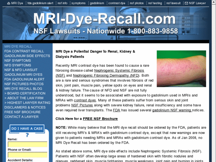 www.mri-dye-recall.com