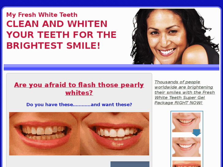 www.myfreshwhiteteeth.com