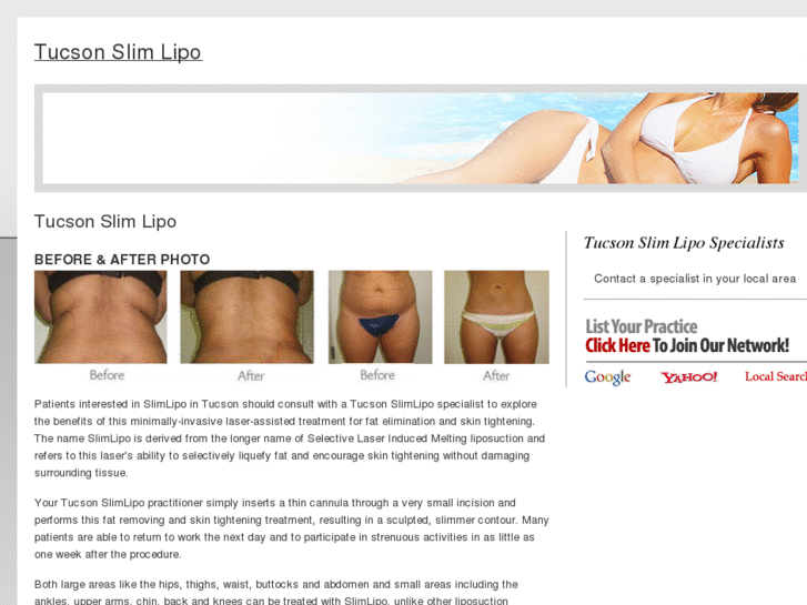 www.tucsonslimlipo.com