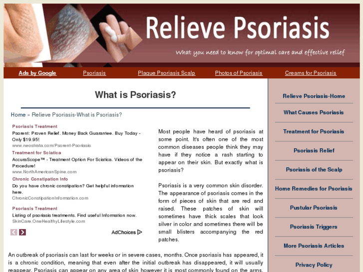 www.relievepsoriasis.com