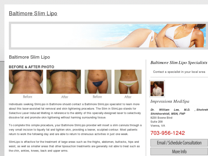 www.baltimoreslimlipo.com