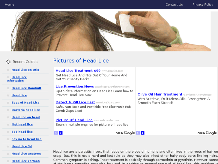 www.picturesofheadlice.com