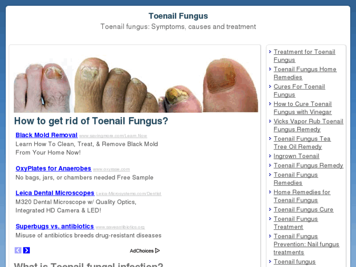 www.toenailfungi.com