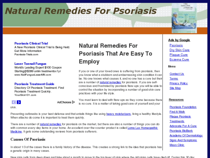 www.naturalremediesforpsoriasis.net