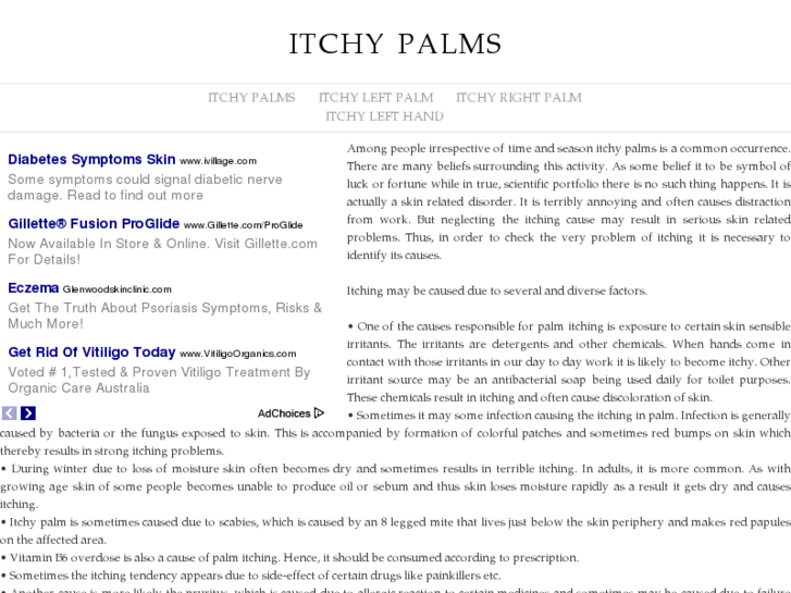 www.itchypalms.info