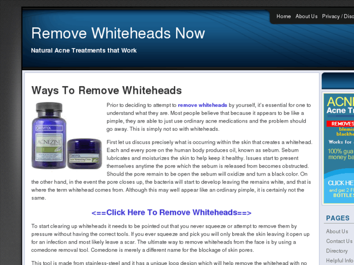 www.removewhiteheadsnow.com