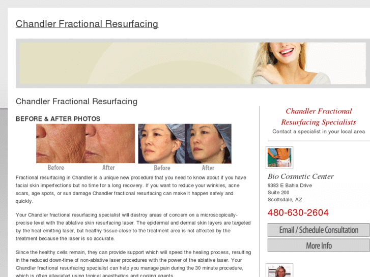 www.chandlerfractionalresurfacing.com