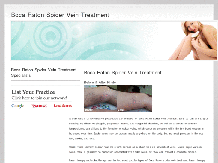 www.bocaratonspiderveintreatment.com