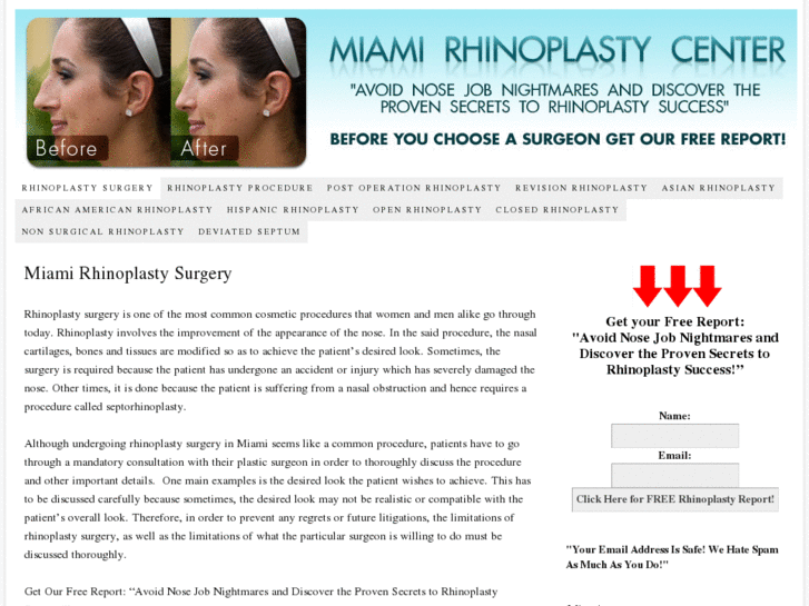 www.miamirhinoplasty.com