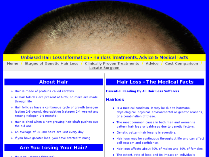 www.hairlossinfo.com.au