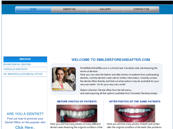 www.smilebeforeandafter.com