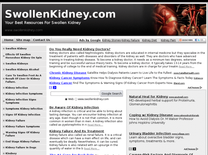 www.swollenkidney.com