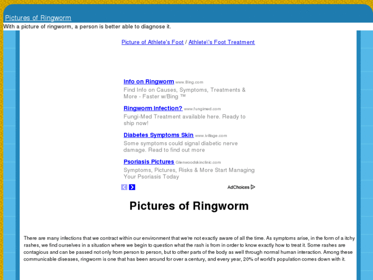 www.pictureofringworm.com