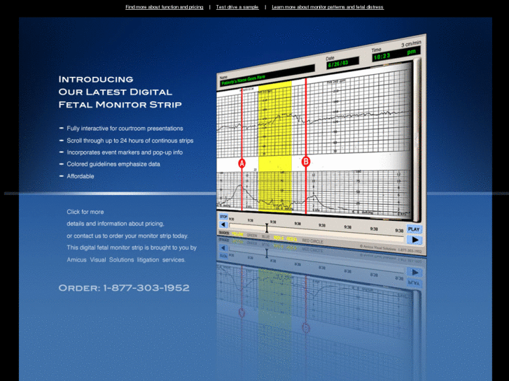 www.fetalmonitorstrip.com