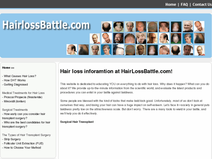 www.hairlossbattle.com