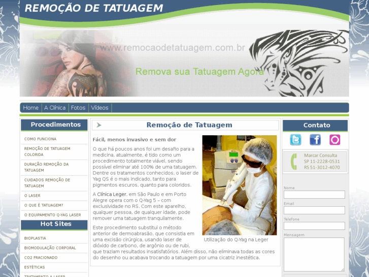 www.remocaodetatuagem.com.br