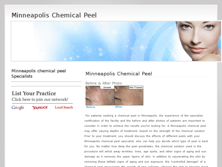 www.minneapolischemicalpeel.com