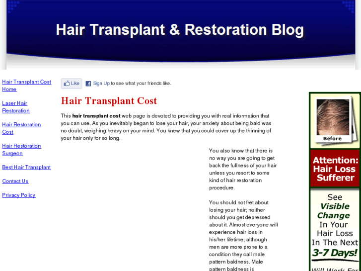 www.hairtransplantcostblog.com