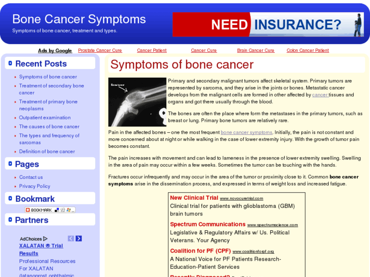 www.bonecancersymptoms.org