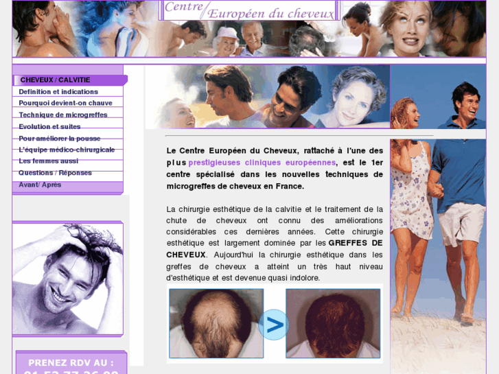 www.greffes-cheveux.com