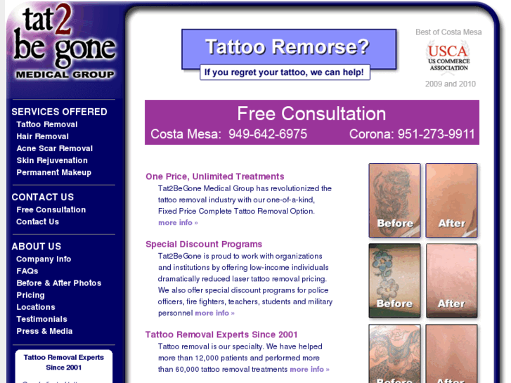 www.tat2begone.com