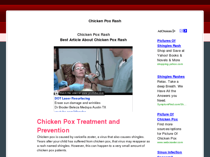 www.chickenpoxrash.org