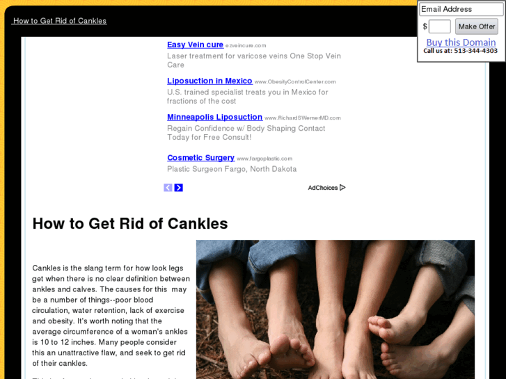 www.howtogetridofcankles.com