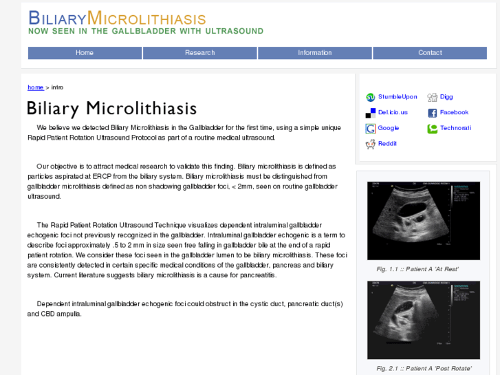 www.biliarymicrolithiasis.com