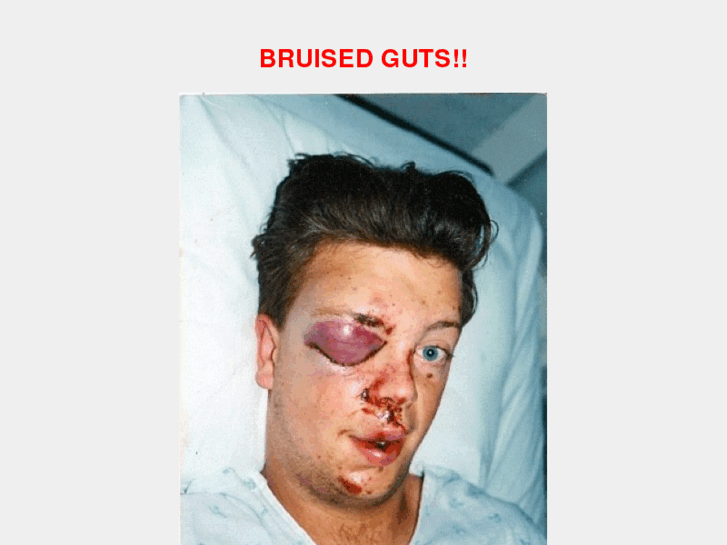 www.bruisedguts.com