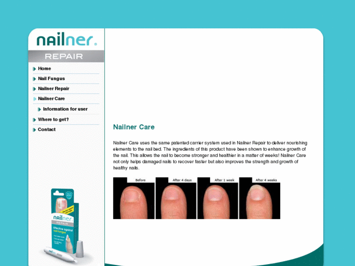 www.nailnercare.com