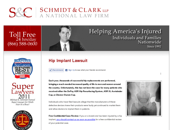 www.hipimplantlawsuit.org