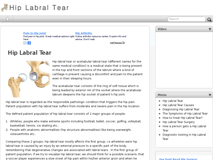 www.hiplabraltear.org