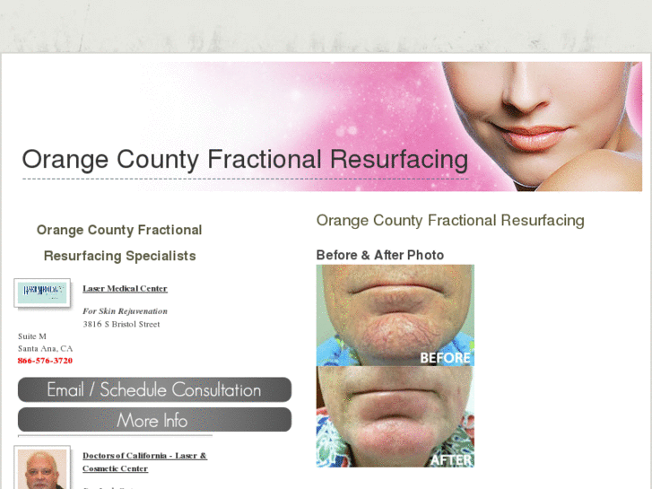 www.orangecountyfractionalresurfacing.com