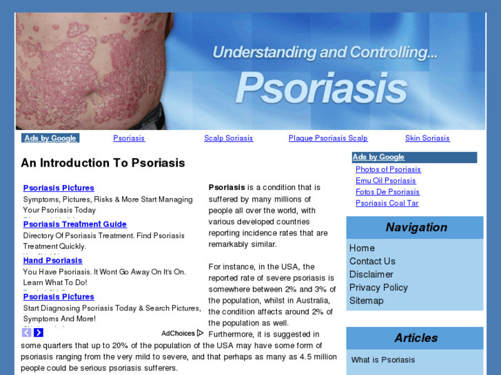 www.psoriasisinformation.org