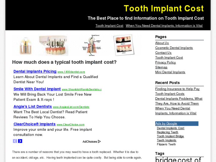 www.toothimplantcost.org