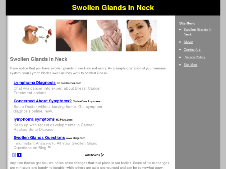 www.swollenglandsinneck.com