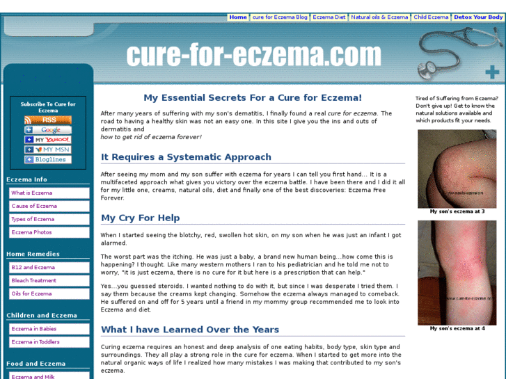 www.cure-for-eczema.com