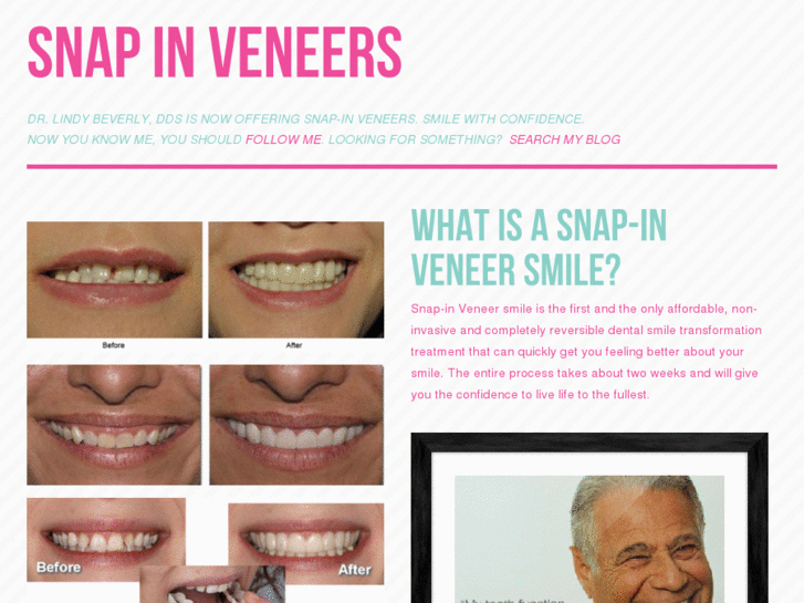 www.snapinveneers.org