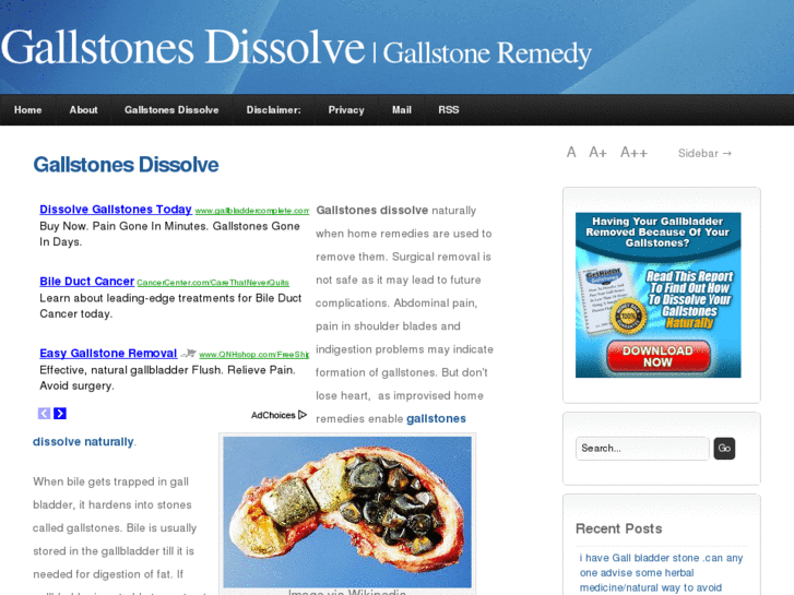 www.gallstonesdissolve.com