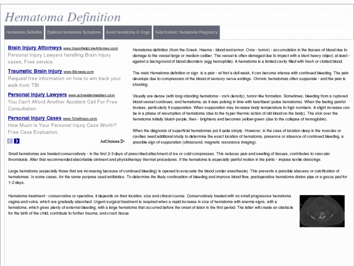 www.hematomadefinition.com