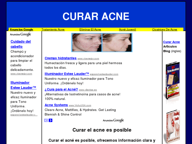 www.curaracne.com