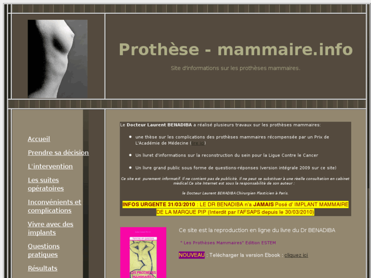 www.prothese-sein.com