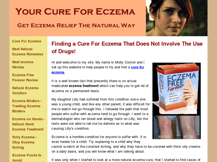 www.yourcureforeczema.com