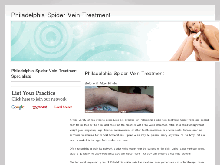 www.philadelphiaspiderveintreatment.com