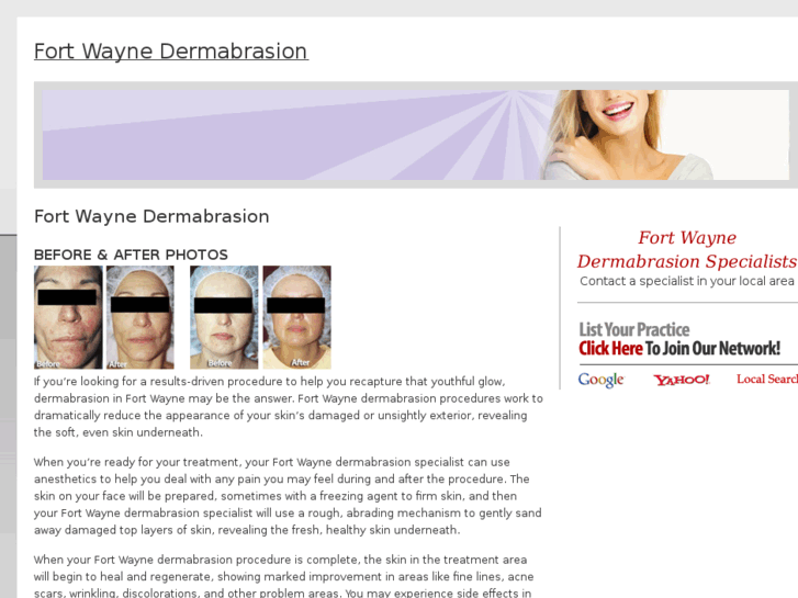 www.fortwaynedermabrasion.com