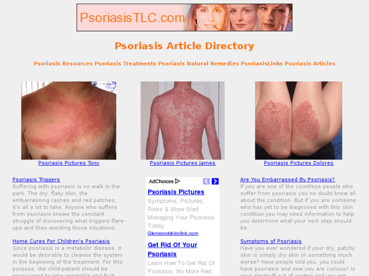 www.psoriasistlc.com