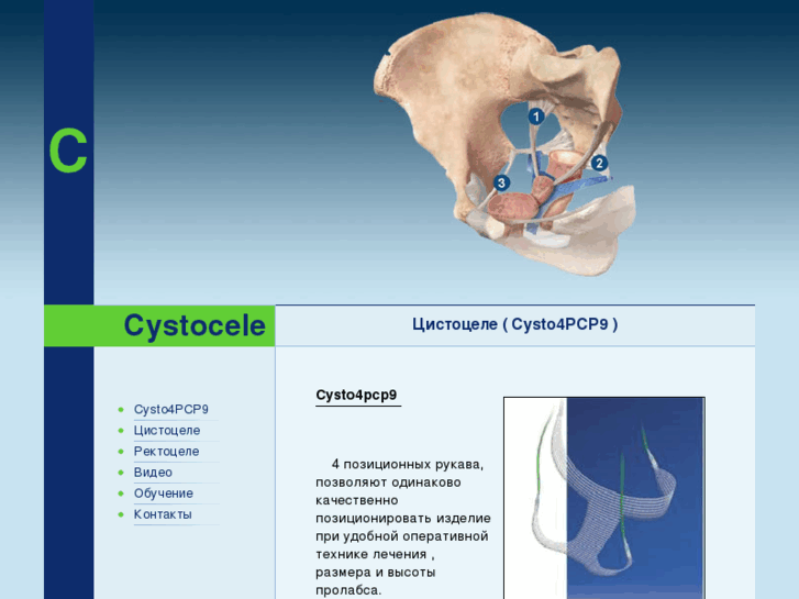 www.cystocele.ru