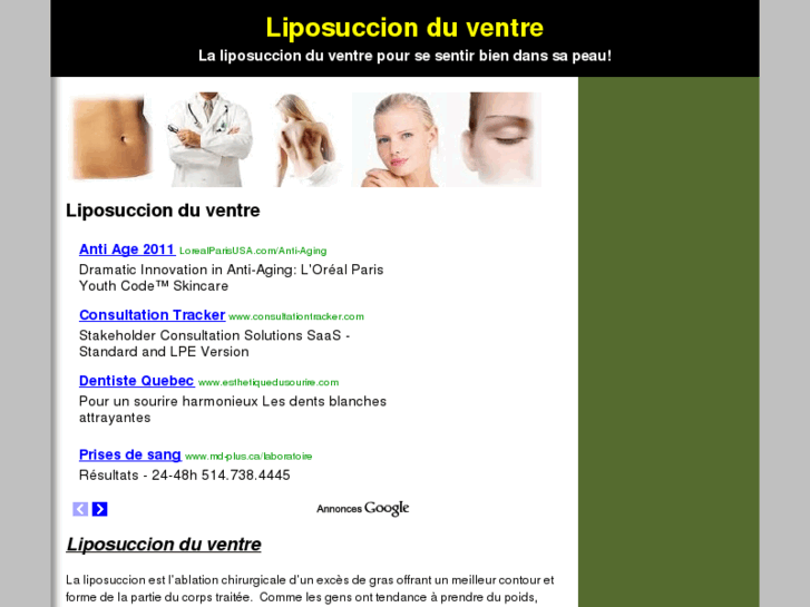 www.liposuccionduventre.net