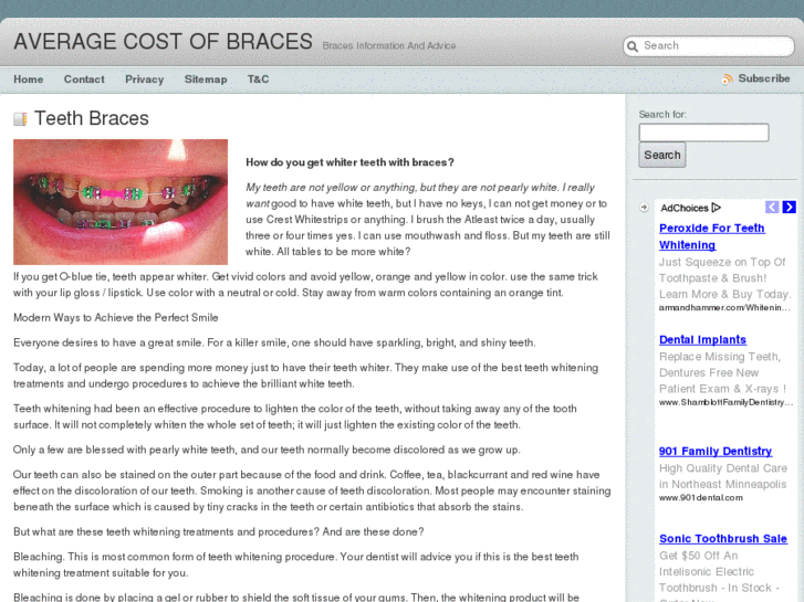 www.averagecostofbraces.net