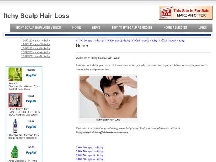 www.itchyscalphairloss.net